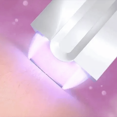 SKN™ - Hair Eraser Laser